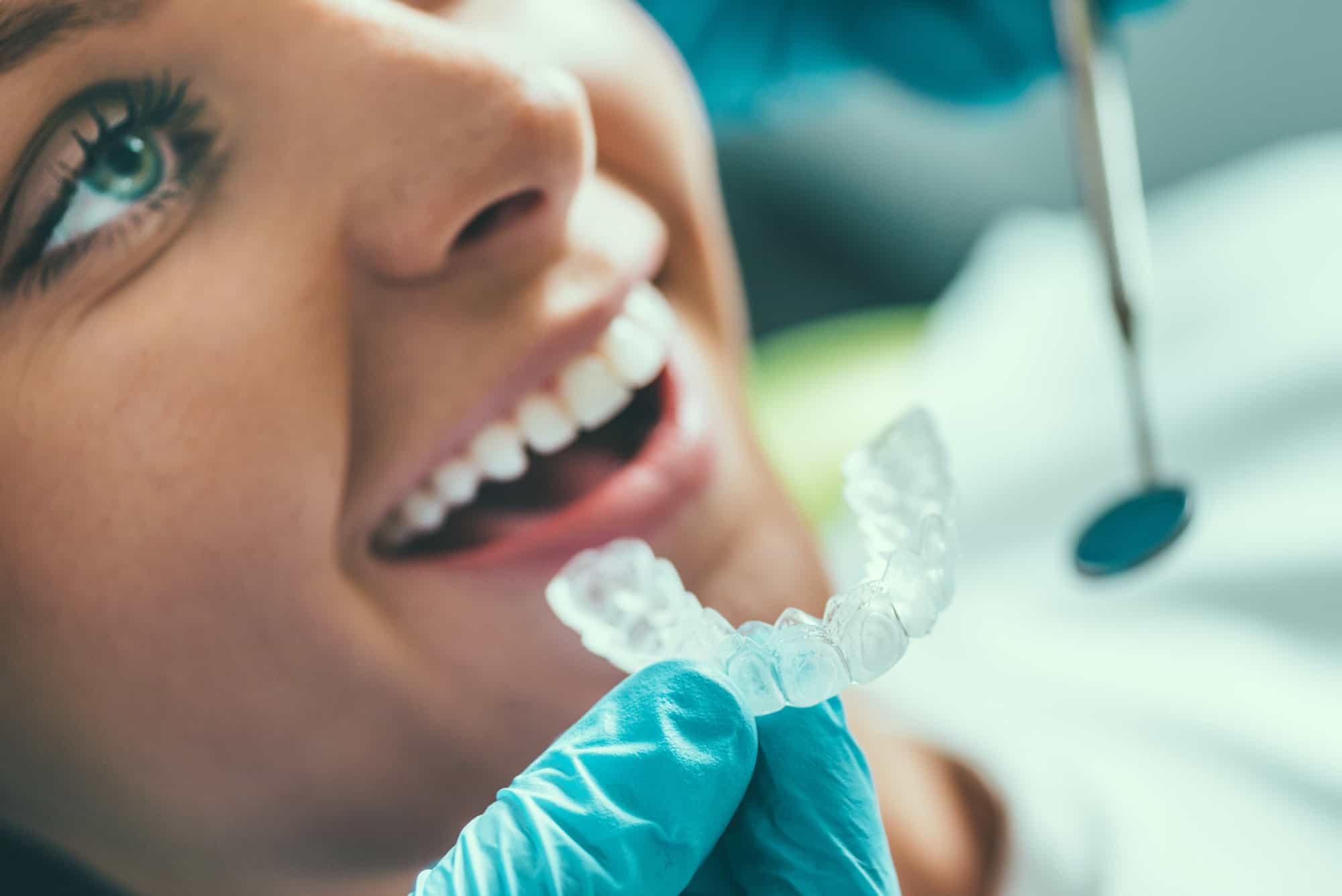 Tooth whitening procedure