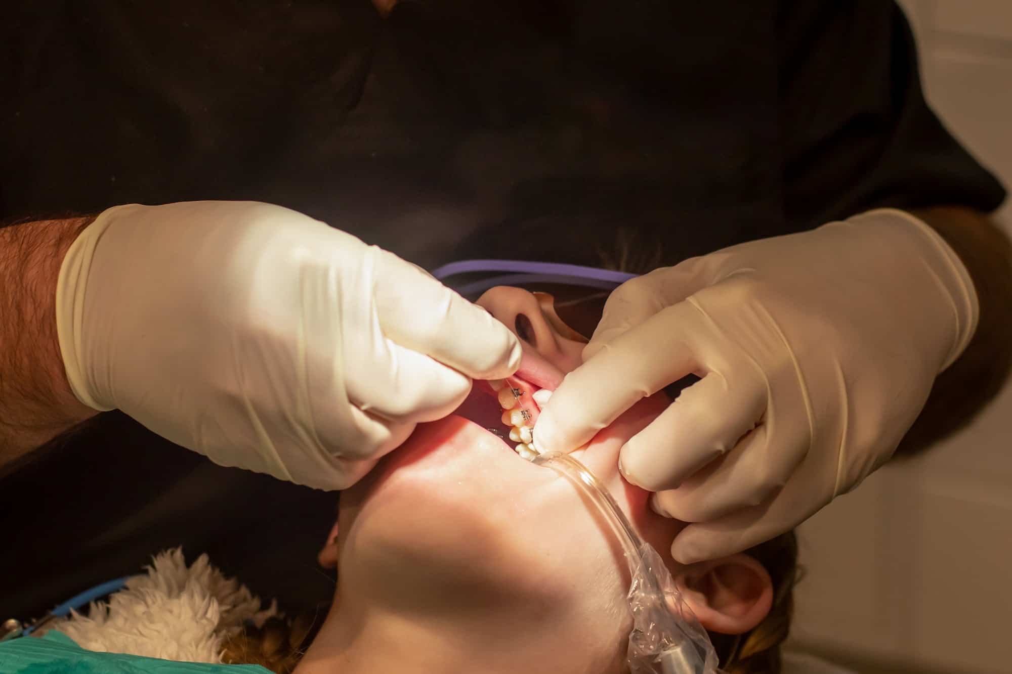 Dental braces installation. Orthodontic treatment