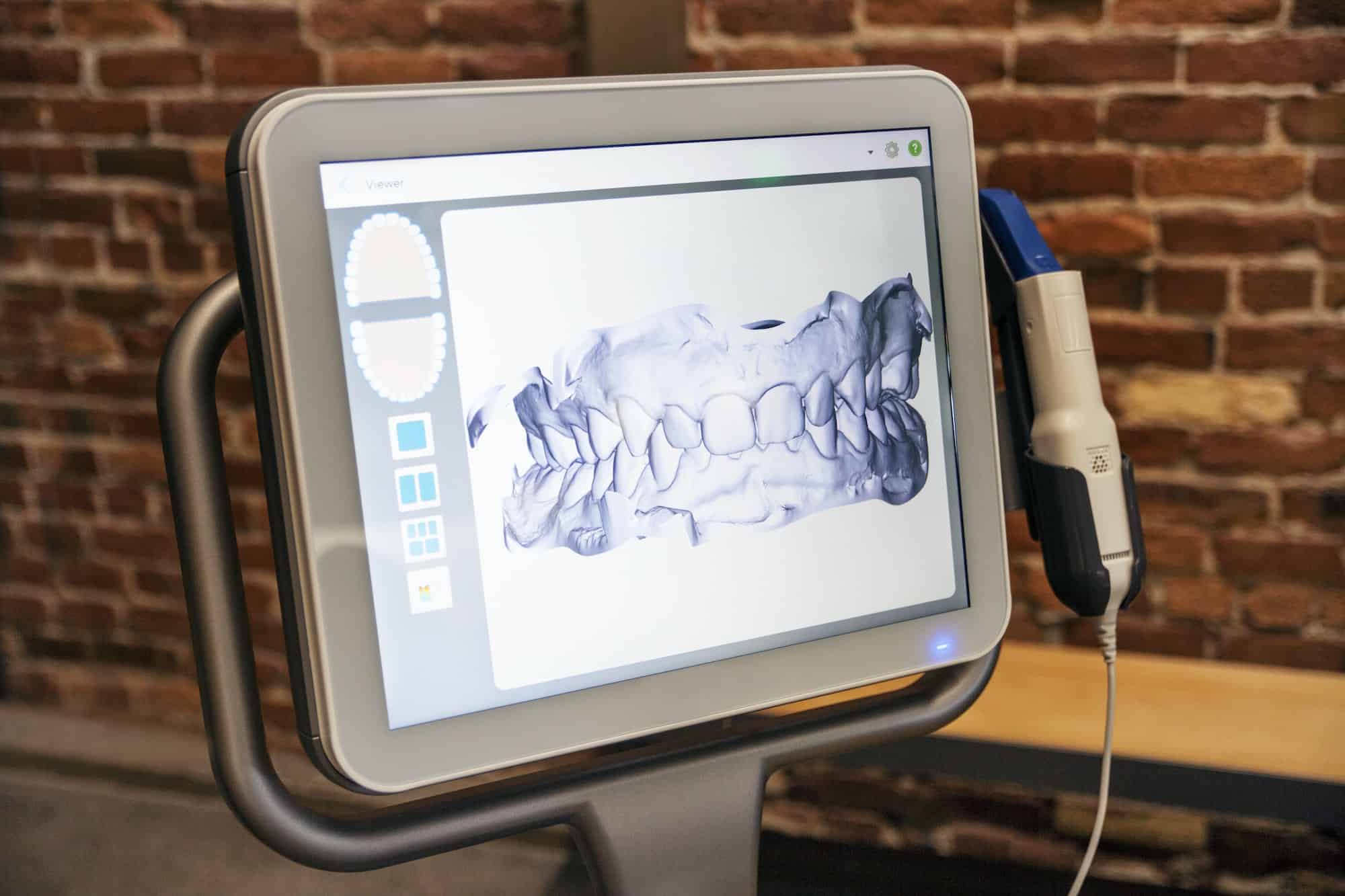 Dental X-ray On Computer Screen In Clinic