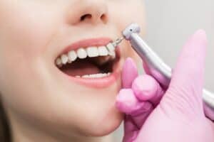 Dentist brushes teeth young girl. Teeth whitening procedure